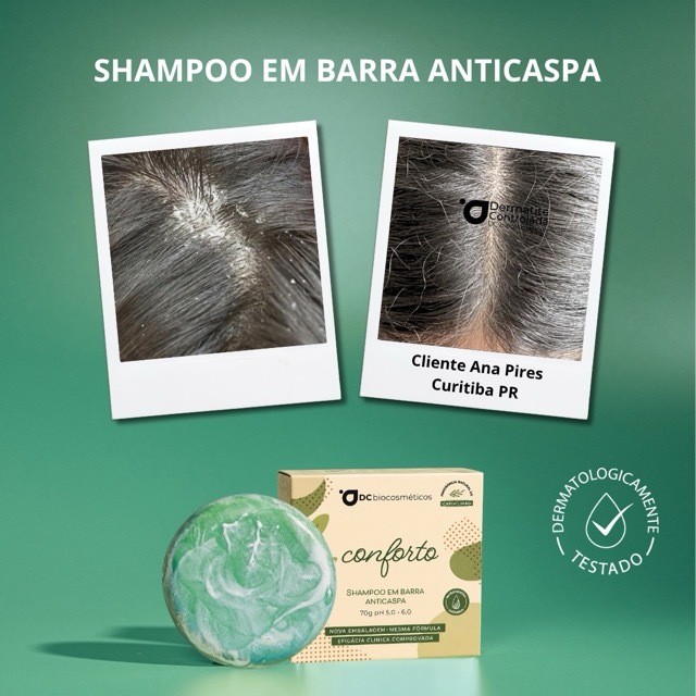 Shampoo Anticaspa Natural em Barra | Dermatite Controlada