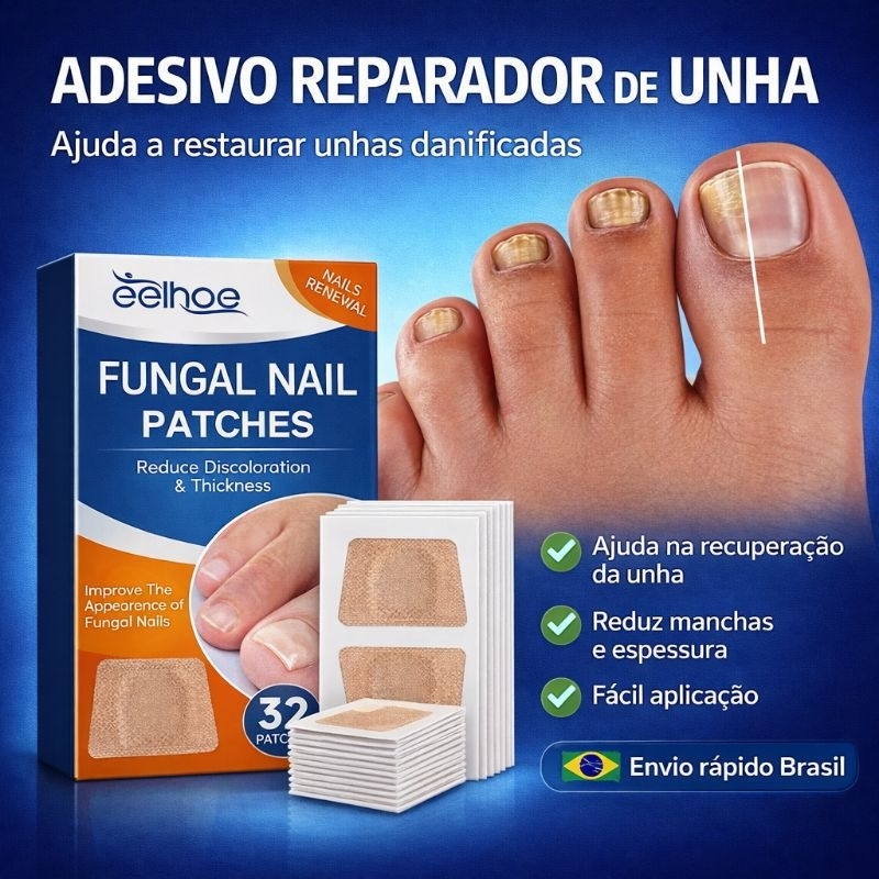 Kit Adesivo Reparador de Unhas dos Pés Cinza Fungo Unha Espessa Correção de Unhas das Mãos Infecção Paroníquia em Oferta na Shopee