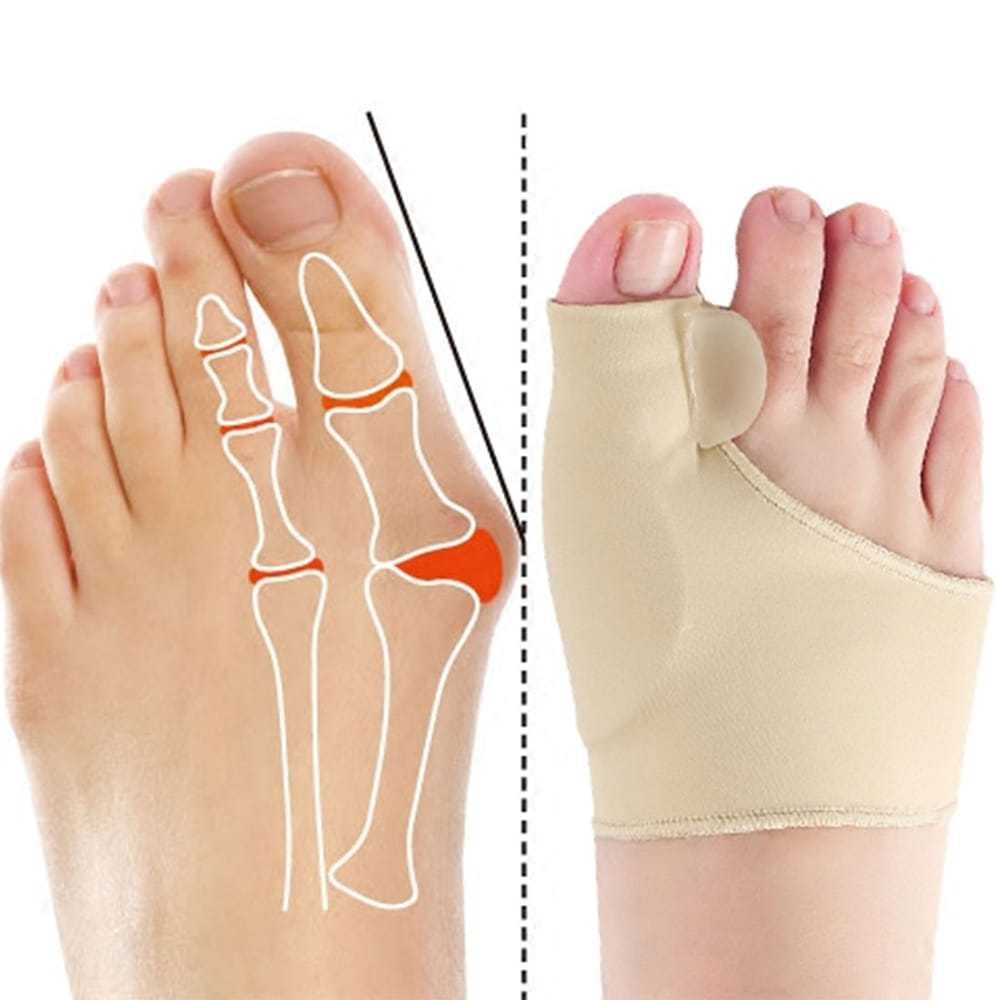 Kit Pares Meia Protetor Joanete Ergonômico Gel Silicone Corforto Dos Pés coluna escritório salão manicure dia dia