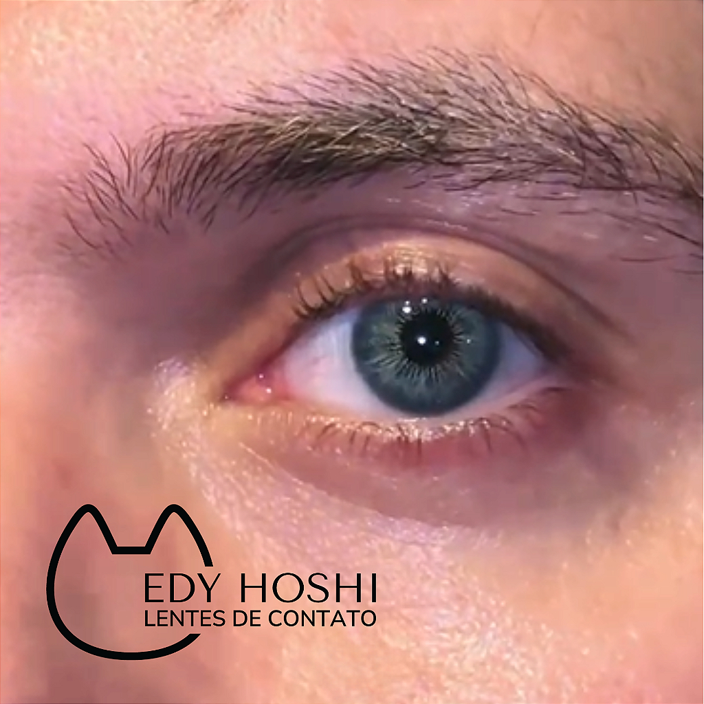 COM GRAU - Lente de Contato Edy Hoshi Glamour Quartzo - ANUAL Pupila reduzida Natural Original Par
