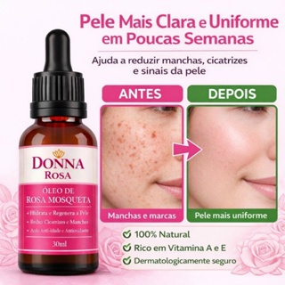 Óleo Vegetal de Rosa Mosqueta Rubiginosa 100% Puro Donna em Oferta na Shopee