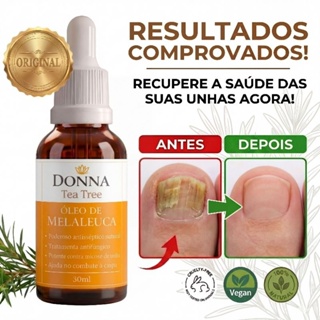 Óleo de Melaleuca Tea Tree Donna 30ml 100% Natural para Unhas e Micose de pele em Oferta na Shopee