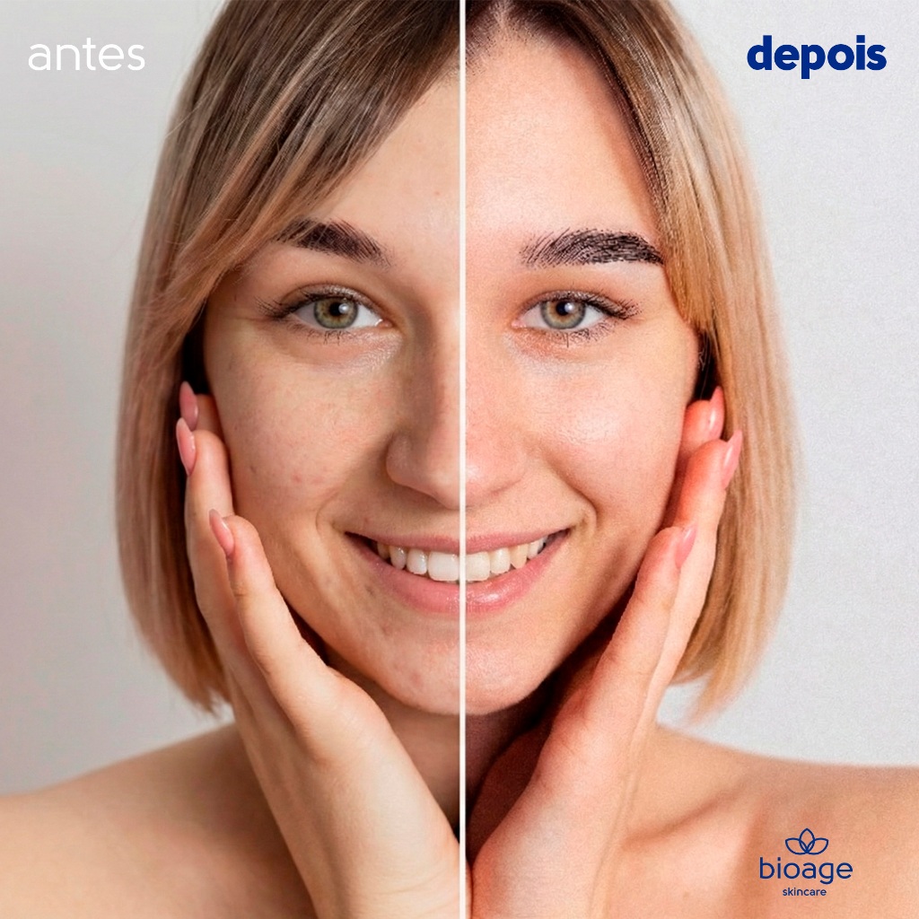 Sabonete Líquido Antiacne BioAge Bio Acne Solution Cleanser Gel de Limpeza Profunda Controle de Oleosidade 120ml
