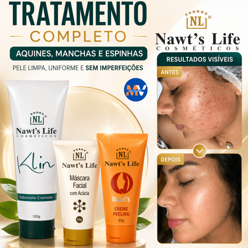 Kit Façial Nawts Life | Sabonete Klim + Creme Peeling Esfoliante + Máscara de Acácia Remove Acne Cravos Espinhas Manchas