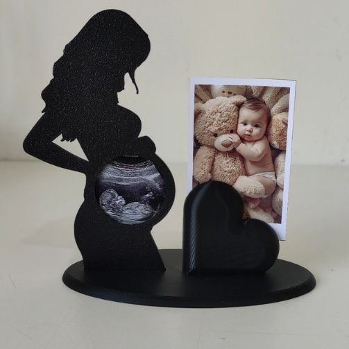 Porta Retrato ultrassom Gestante - Dia das mães