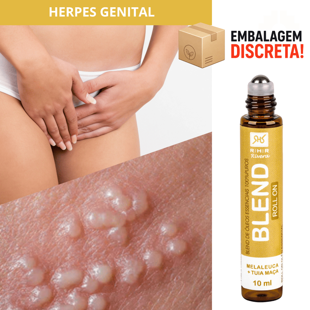 Herpes Genital - Blend Roll-on 10ml