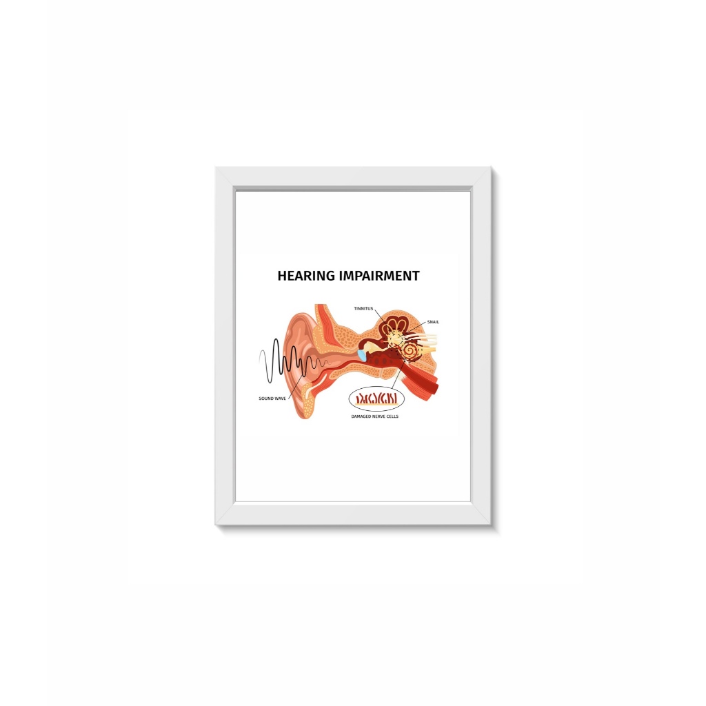 Quadro Decorativo Ouvido Decoração Consultório Médico Otorrinolaringologia Moldura 30x40cm Madeira