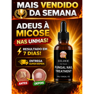 ACABE COM A MICOSE NAS UNHAS RÁPIDO! TRATAMENTO PODEROSO ANTI-FUNGOS + RESULTADOS VISÍVEI…