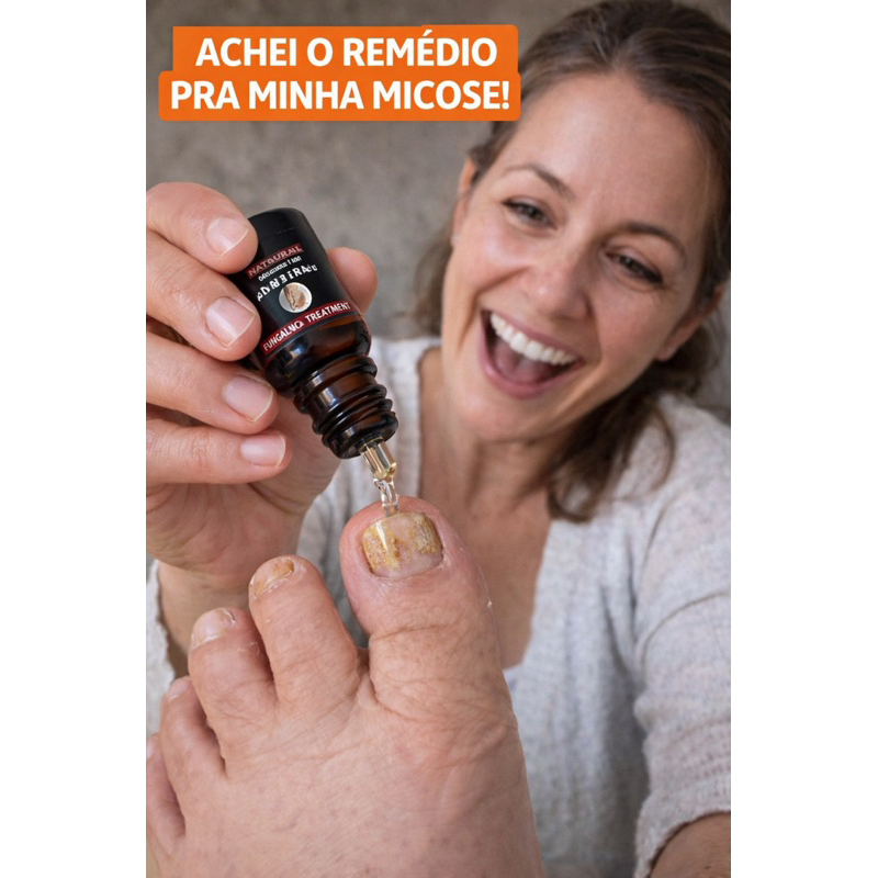 Tratamento para Micose de Unha Antifúngico Óleo Fungicida Remove Fungos Unha Amarelada Forte e Grossa 10ml preta