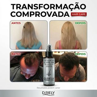 Tonico Capilar Crescimento Cabelo Barba Sobrancelha Antiqueda Fortalecimento Rápido em Oferta na Shopee