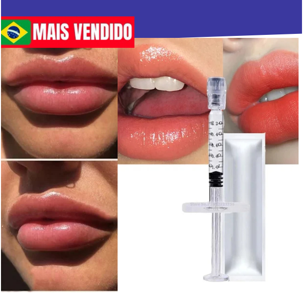 Harmonizaçao facial e labial 2 ml