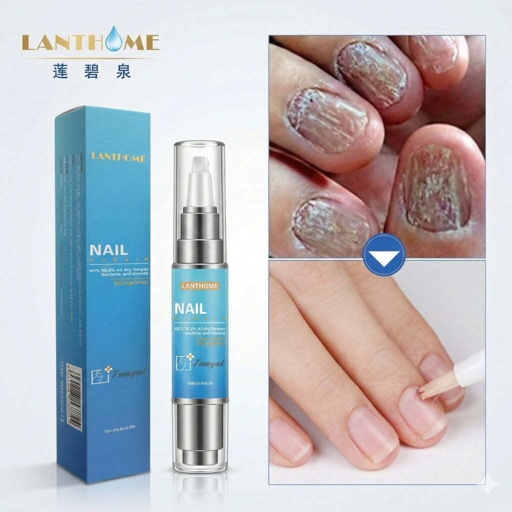 Caneta Unhas Com Solução  LANTHOME Anti Micose E Anti Fungos Bactérias Tratamento De Micose Na unha