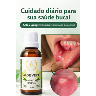 Óleo de Aloe Vera Babosa Premium 30ml Vegetal Aftas e Gengivites na Boca em Oferta na Shopee