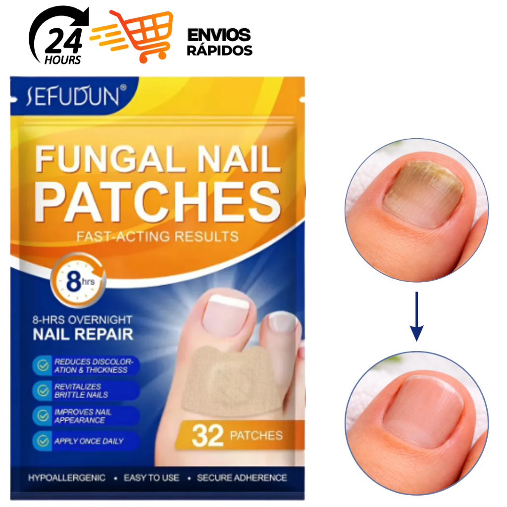 Kit Adesivo Reparador de Unhas dos Pés Fungo Unha 32/64 pcs