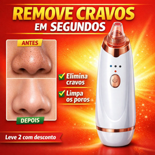 Removedor de Cravos a Vácuo VacuumSkin Pro Elite™ Limpador de Poros Facial Profissional 5 Ponteiras em Oferta na Shopee