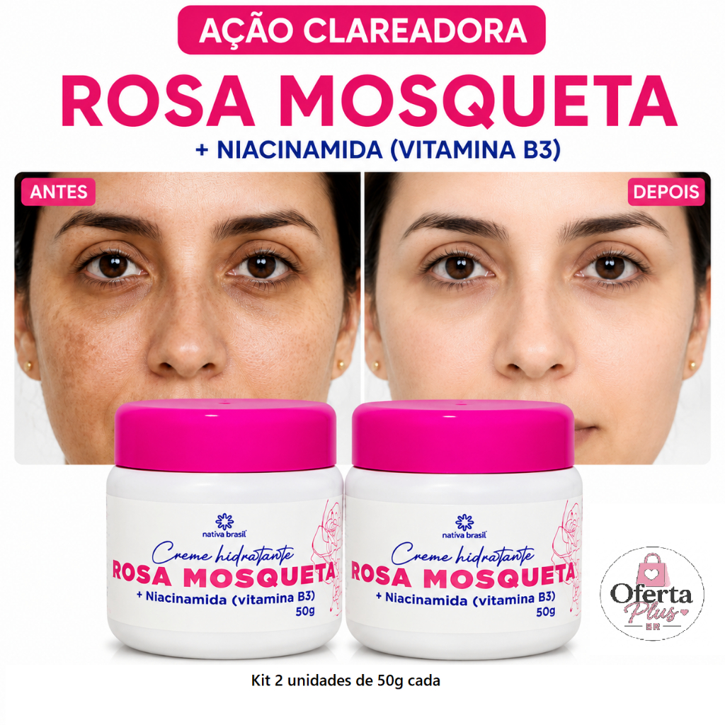 Kit 2 Creme Rosa Mosqueta + Niacinamida  50g clareador Pele com melasma olheira, manchas nas axilas