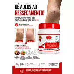 Creme Para Os Pés Rachados Ressecados E Mãos Secas Com Uréia Óleo De Amendoas 240g