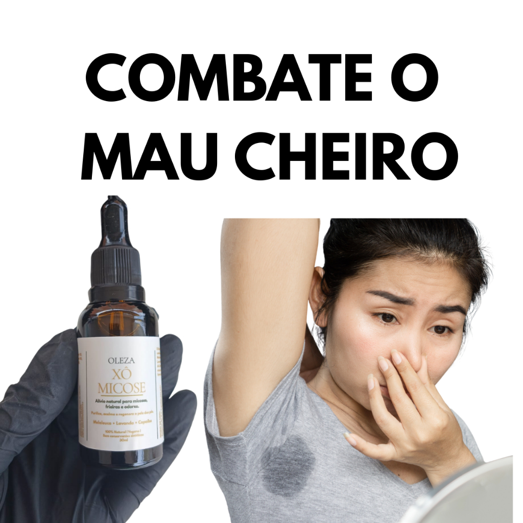 Óleo Natural de Melaleuca e Copaiba Combate Mau Cheiro nas Axilas e Pés | Antifúngico e Antisséptico 30ml em Oferta na Shopee