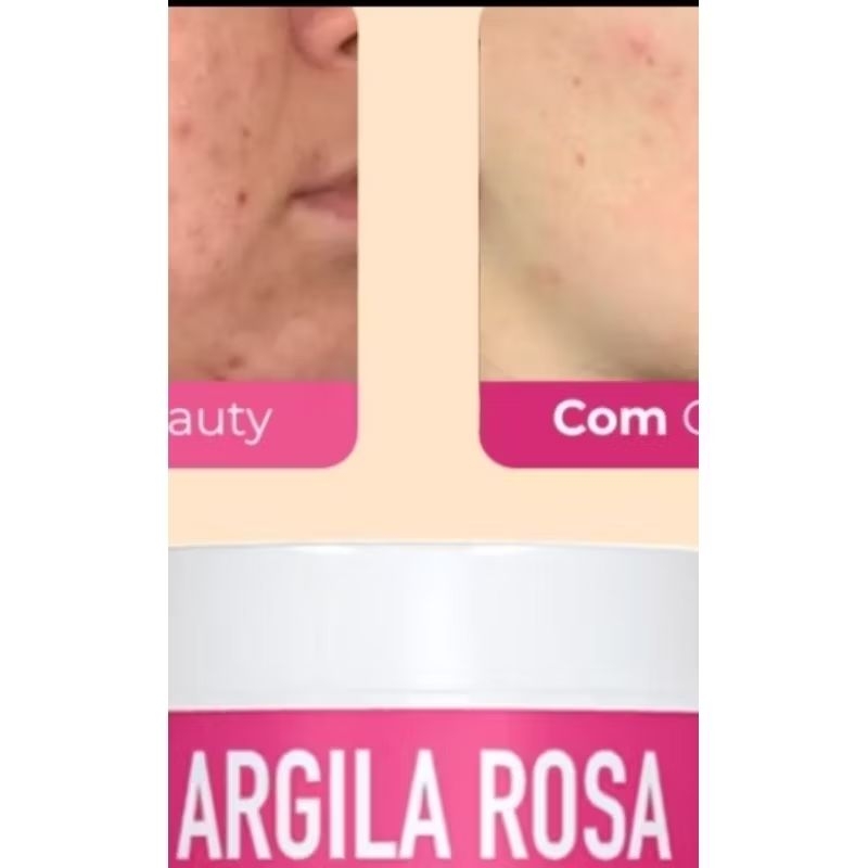 01 Pote De Argila Rosa de 400G Esterilizada Com laudo Vegana 100% natural +01 Sabonete de Argila Rosa líquido de 100 ml.