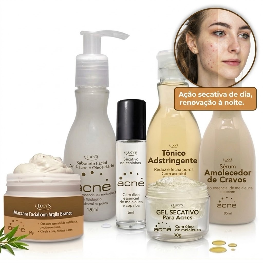 Kit Completo Anti Acne e Cravos Pele Lisinha Lucy's - 6 Produtos Essenciais