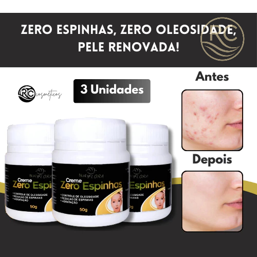 Kit com 3 Cremes Zero Espinhas – Controle de Oleosidade e Hidratação na Medida Certa