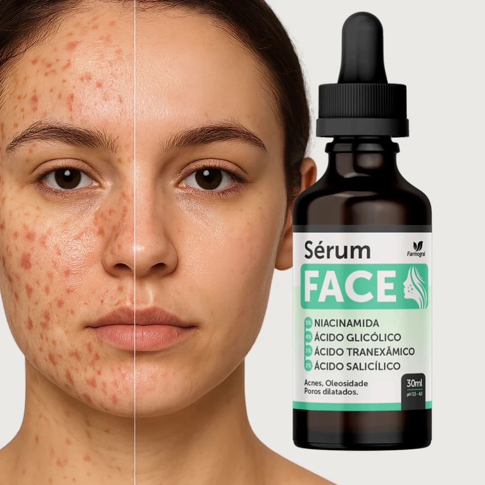 Sérum Clareador de Manchas Facial Cravos e Espinhas - 30ml - Envio Imediato