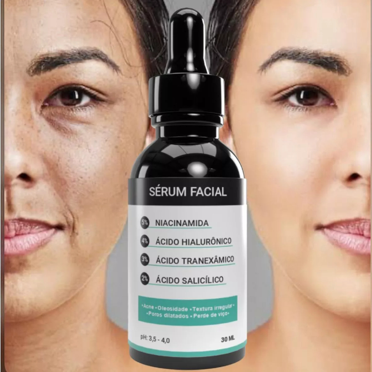 Sérum Clareador de Manchas Facial Mix De Niacinamida, Glicólico, Ácido Tranexâmico, Ácido Salicílico