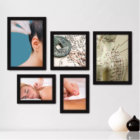 Quadros decorativos 5 peças mosaicos para sua sala ou quarto Acupuntura - Medicina Alternativa Star = 285