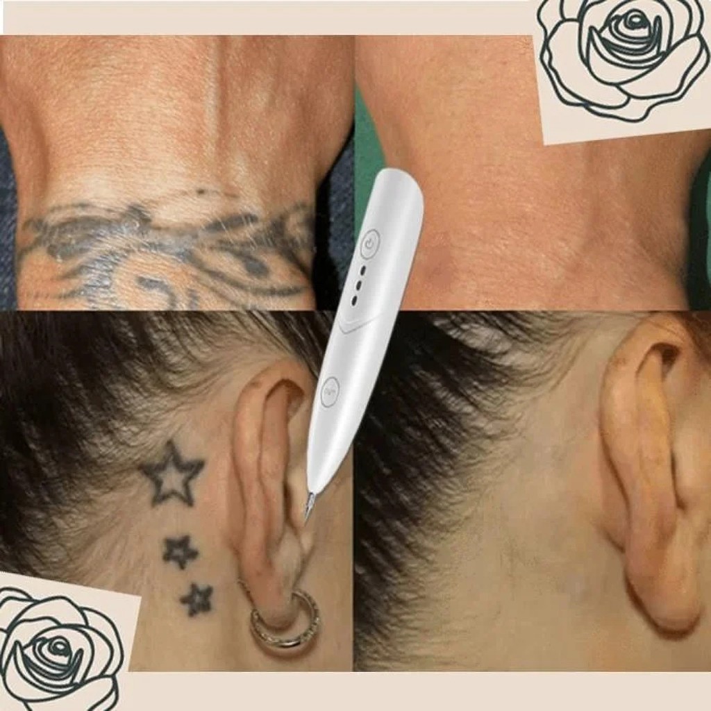 Caneta De Remocao De Tatuagem Sp Ot Instancias Sorvete Instantaneo Shopee Brasil