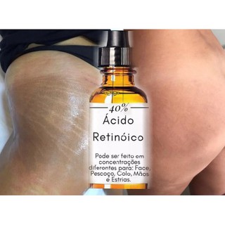 Removedor de Estrias (ácido Retinoico 20ml)