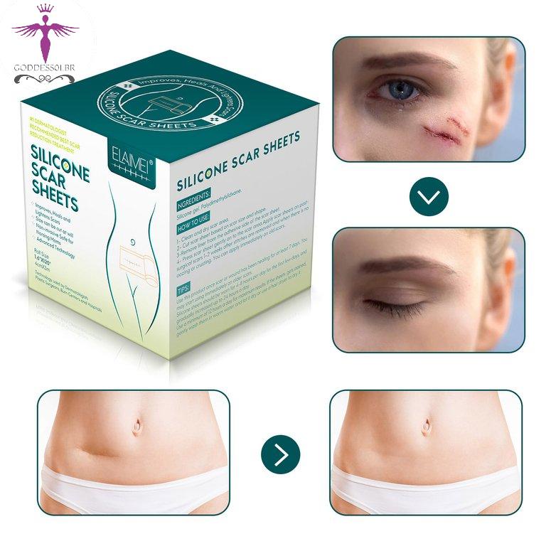 silicone based scar treatment gel