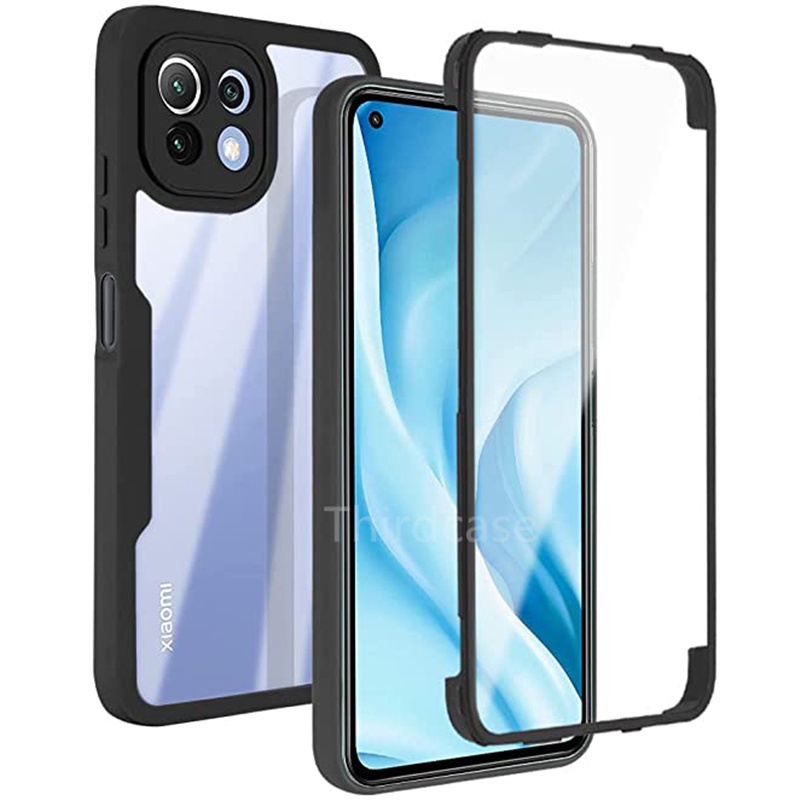 Cover 360° Trasparente Per Xiaomi Mi 11i - Custodia Fronte/Retro In TPU Morbido - Foto 2