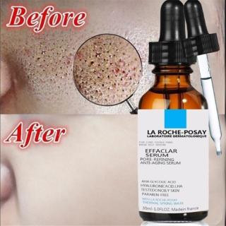 Soro Eficaz De Refinamento De Poros Com Ácido Glicólico 10/20/ml