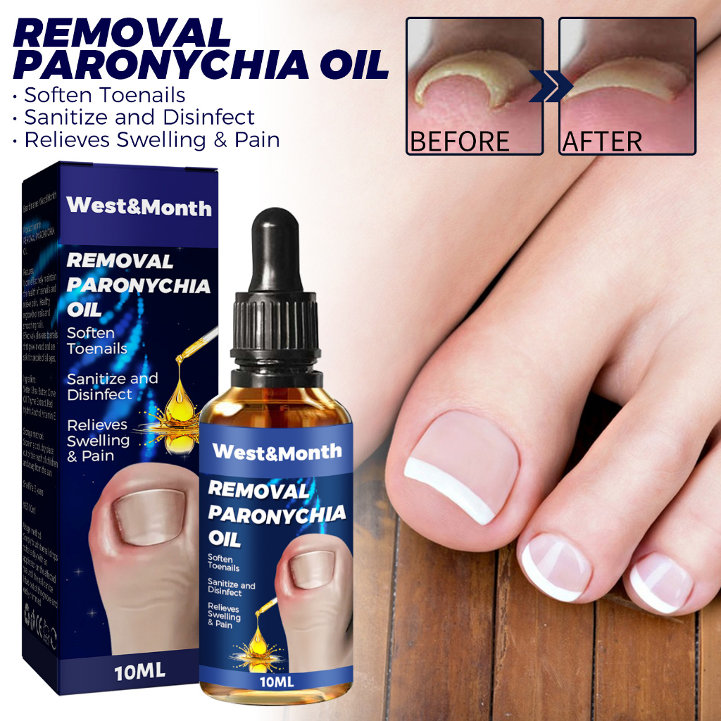 Óleo De Remoção De Paroníquia , Reparo De Unhas Encravadas , Alívio De em Oferta na Shopee