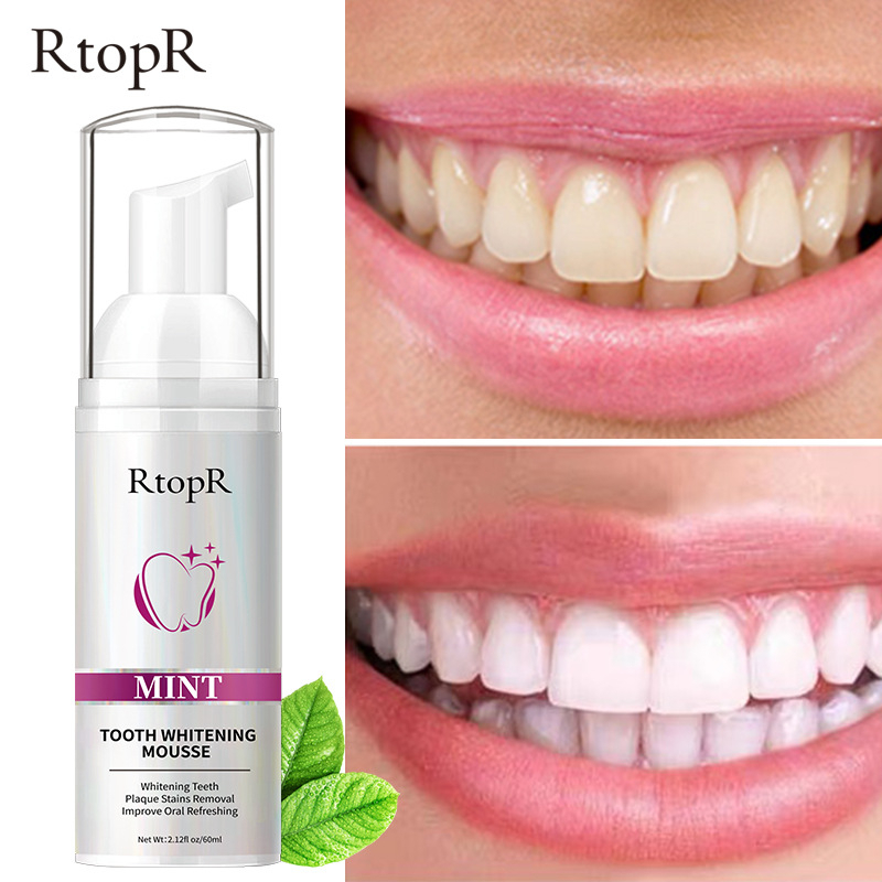 RtopR Clareamento Dental Mousse Branqueador De Dentes Clareador De Dente Dentária Remoção De Manchas Branqueamento Dentário De Higiene Oral Creme Dental Ferramenta Bucal Removedor De Placa Fresca