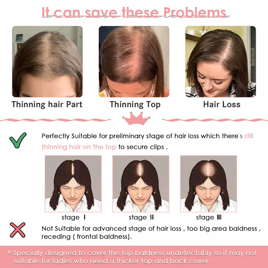 Toppers De Cabelo 45cm Peças Para Cabeleireiro Feminino Sintéticas Com Desbaste 100g De Peso