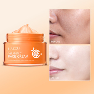 LAIKOU Vitamina C Fade Blemishes Creme Hidratante Brilhante Iluminar Espinhas Marcas De Acne 50g