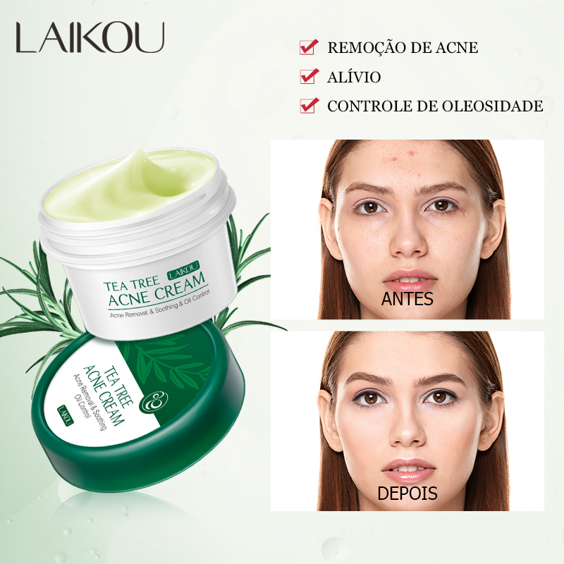 Creme Facial Para Árvore De Chá/Acne/LAIKOU/Controle De Oleosidade/Reparação De Poros 20g - Beauty