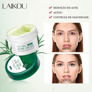 Creme Facial Para Árvore De Chá/Acne/LAIKOU/Controle De Oleosidade/Reparação De Poros 20g