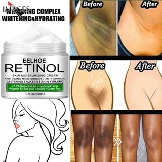 Creme Branqueador Corporal Peças Particulares Soro Para Axilas Brilhante Joelho Interior Coxa Escuro Remover Melanina Íntima