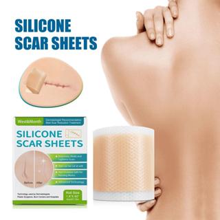Silicone Folhas De Cicatriz Reparo De Pele Patch Remoção Auto-Adesiva Fita Marca Esticada Acne J7S7 em Oferta na Shopee