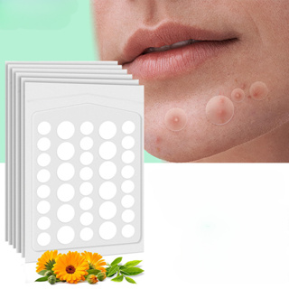 50/20/10 Peças Redondo transparente acne decal cobrir o rosto decal em Oferta na Shopee