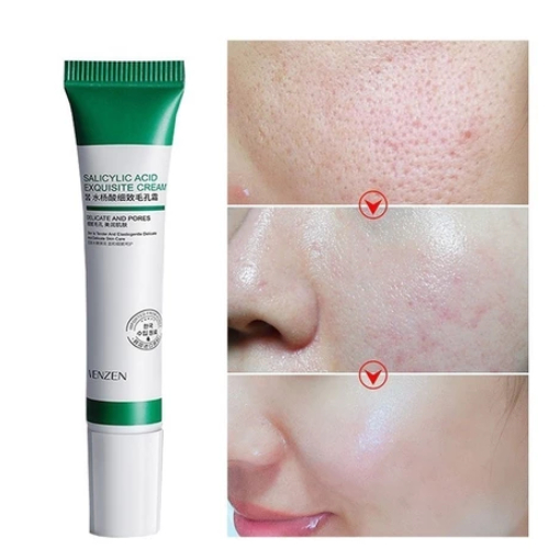 Creme Clareador para a Pele: Onde Comprar | BuscaProdutos