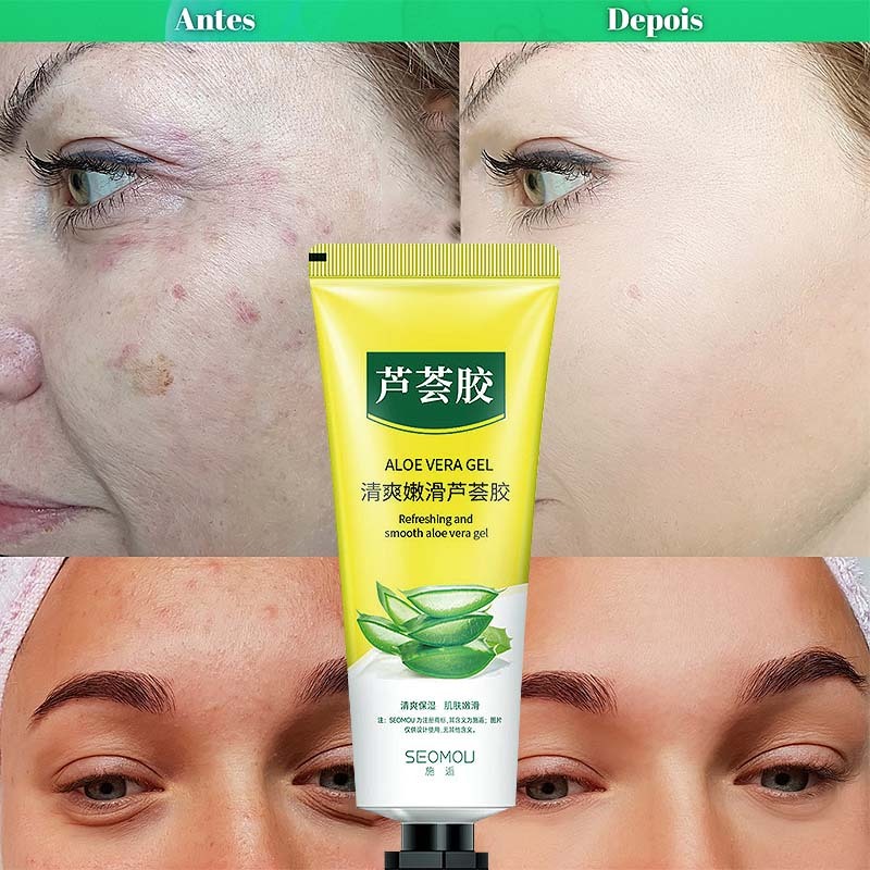 Aloe Vera Babosa Gel Creme Hidratante 30g Refrescante Cuidados Com A Pele Pós-Sol