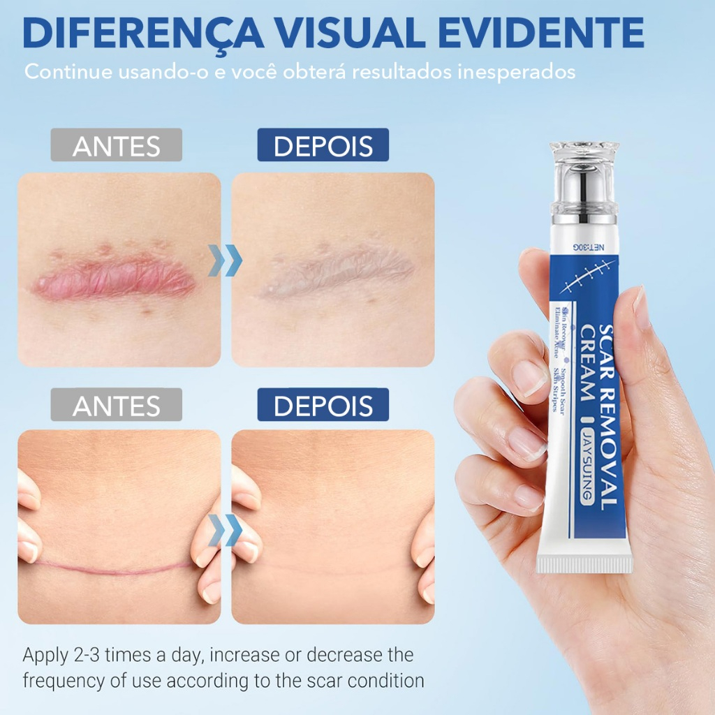 Fade Scar Repair Cream - Reduz e atenua cicatrizes de queimaduras e escaldões