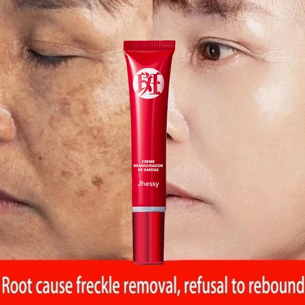 Creme clareador para remoção de sardas, hidratante e iluminador do tom da pele, reduz marcas de Acne em Oferta na Shopee