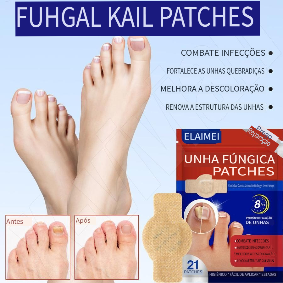 [Entrega 24 horas]EELHOE-Adesivo de tratamento de unhas, antibacteriano de longa duração, repara infecção fúngica