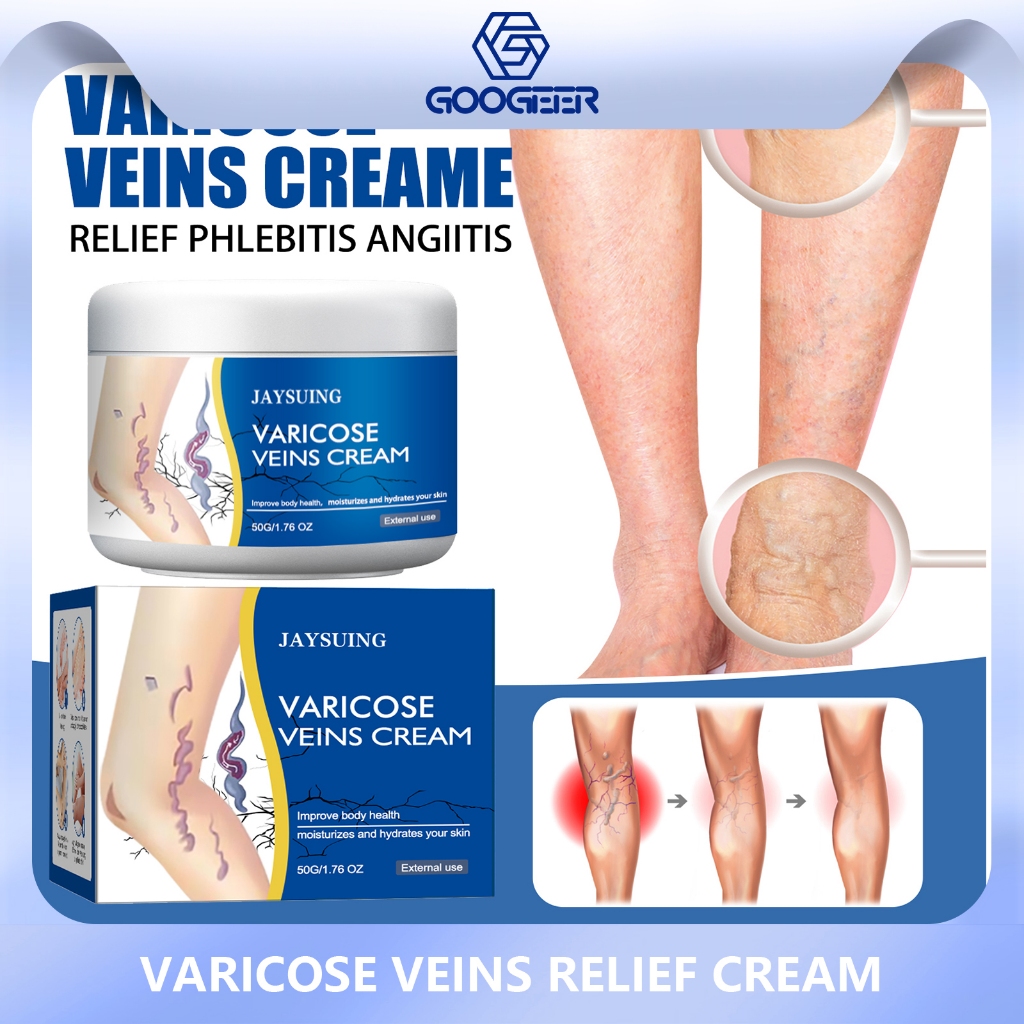 Jaysuing Creme Reparador De Varizes Para Pernas Massagem Suave Calmante Perna Cuidados Corporais Loção De Alívio Externo em Oferta na Shopee
