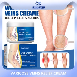 Jaysuing Creme Reparador De Varizes Para Pernas Massagem Suave Calmante Perna Cuidados Corporais Loção De Alívio Externo em Oferta na Shopee
