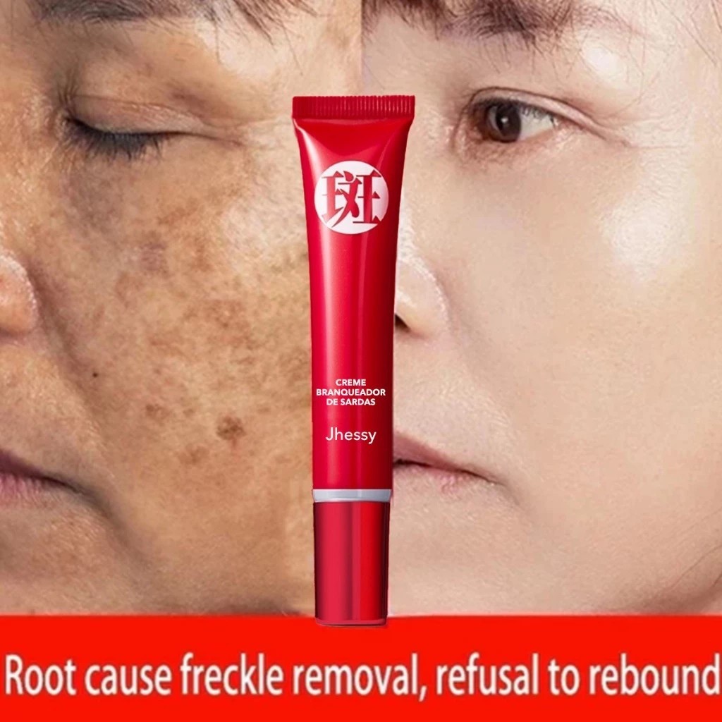 Creme forte original para remover manchas escuras/clareamento pigmentado/cuidados com a pele QRJZ DV4D